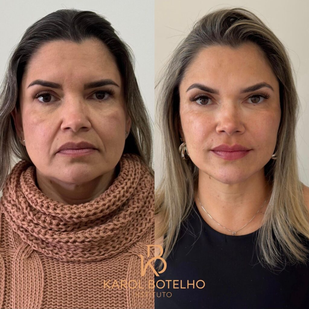 1bb20d7b 2bc3 4458 b810 d24e4430e2f2