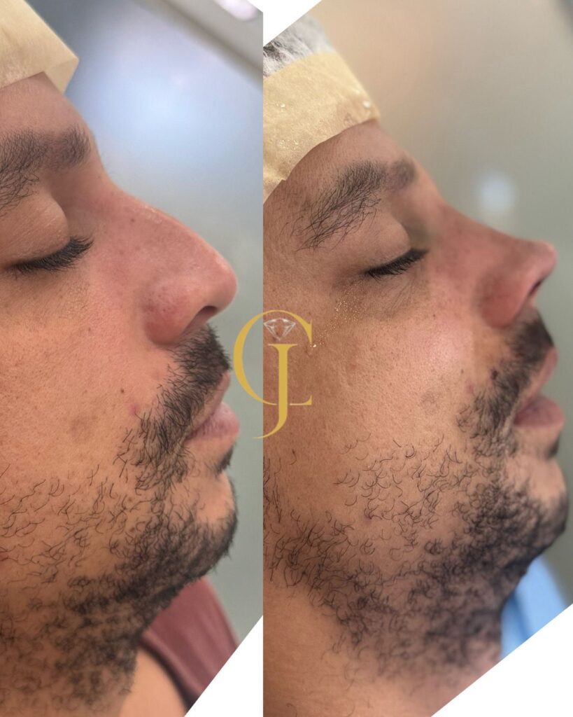 513681f9 bcac 483f a77c 610f070f47b5