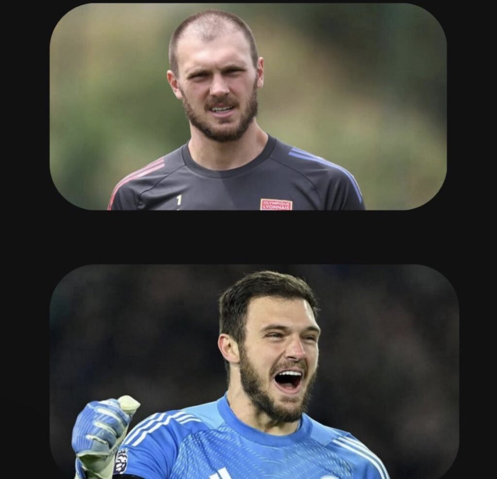 Transplante Capilar De Lucas Perri Surpreende Pela Naturalidade; Procedimento Foi Conduzido Pelo Dr. Felipe Blanco 1 IMG 2653