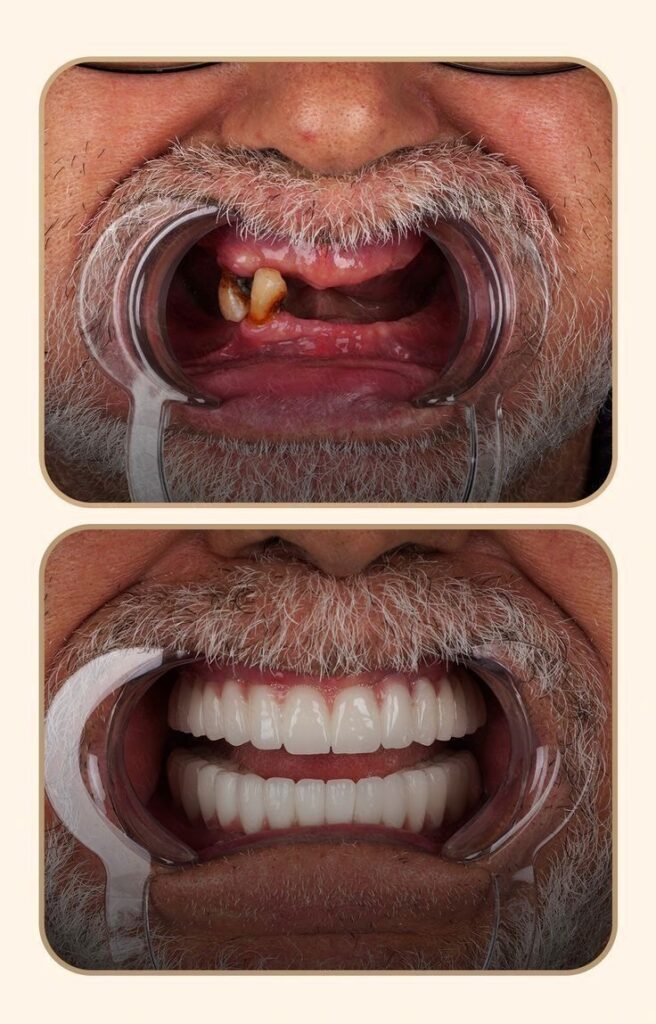 bf514808 807b 4b8d 901d 6306058587c3