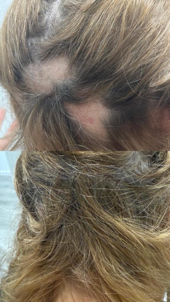 Exossomas: A Nova Era Da Dermatologia Regenerativa 2 1b516d11 d800 416a b868 b310a82f58ef