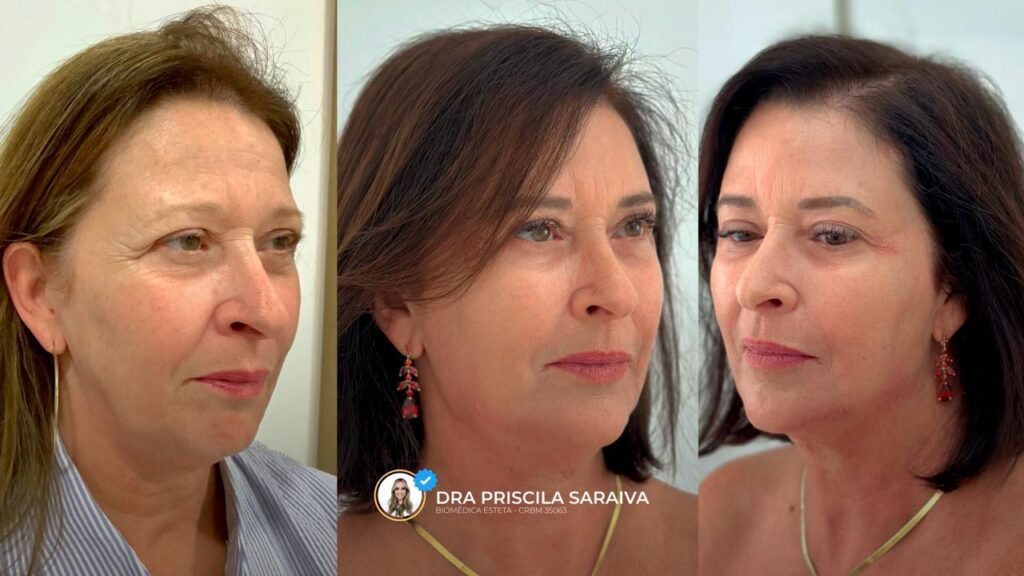 Do Exagero À Elegância: Por Que O Conceito De “Menos É Mais” Domina A Estética Em 2026 1 759ac44b 076c 46a6 b3ed 05efe56f4da0