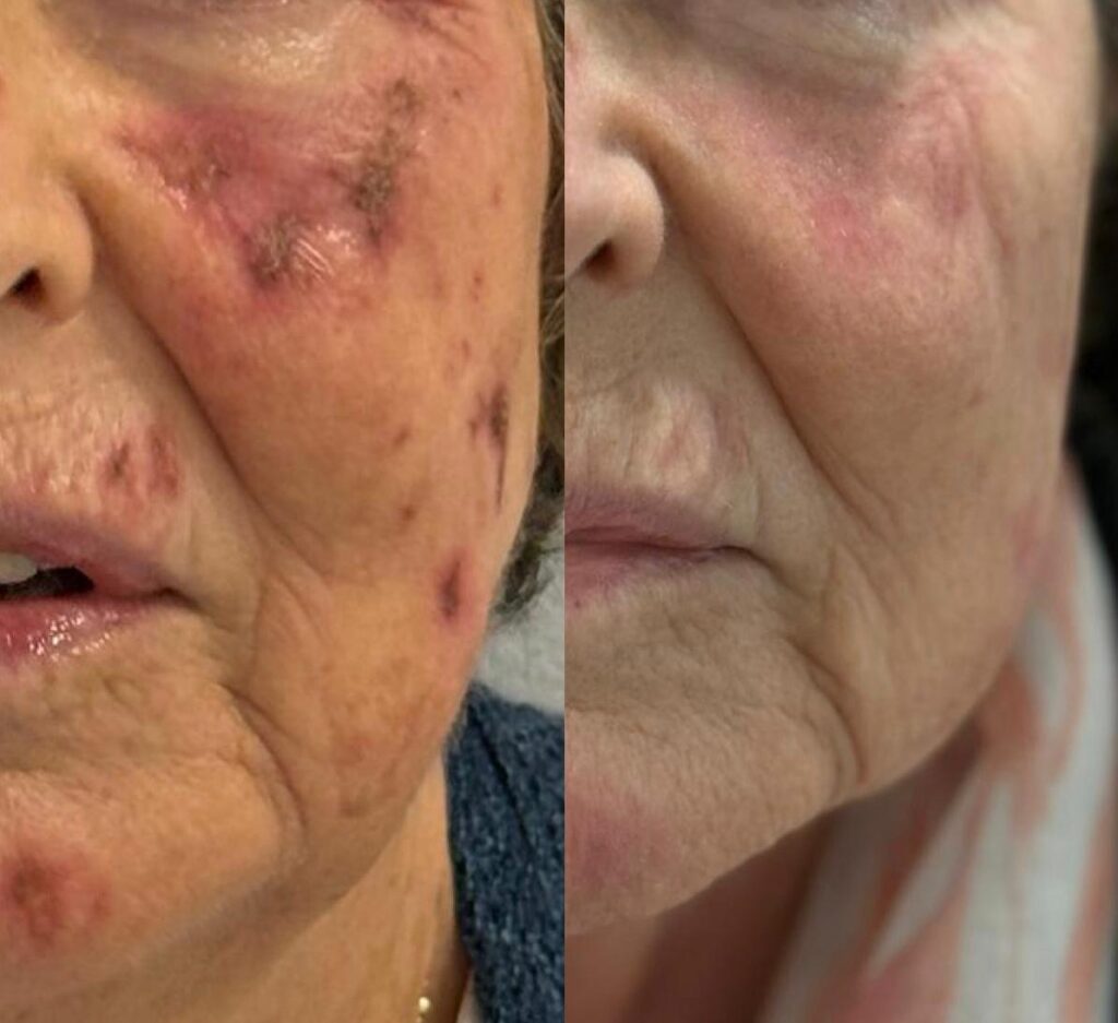 Exossomas: A Nova Era Da Dermatologia Regenerativa 1 80a3b6e8 c86e 47fe 8e51 519842e22c35