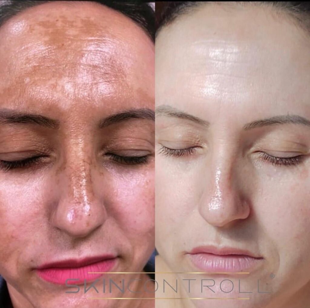 cf5c30e6 5168 4364 82ee 818b39f8642b