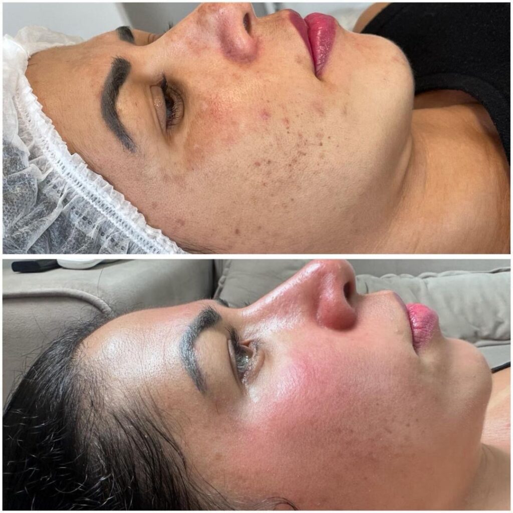 a9c623f4 3787 4a95 a0de 811a04701943