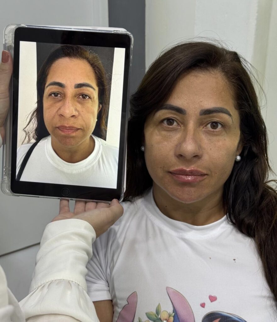 O Novo Padrão Da Harmonização Facial Tem Nome: Dra. Luana Bezerra 2 IMG 5458
