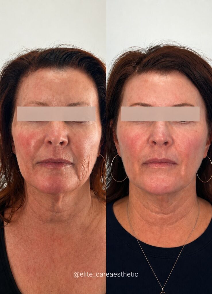 f48a725d 2e96 40eb acb7 ba82919b377e